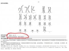 46XX男性性反转综合征原因和特征详解