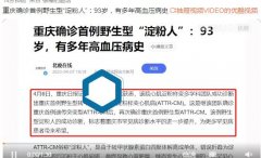 野生型淀粉人是什么意思？因代谢导致的一种罕见心脏病