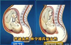 韩国幽灵儿童案真相解析，什么原因导致幽灵婴儿，三个原因
