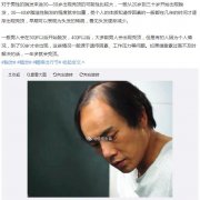 女人眼里秃顶男人是什么感觉，男人秃顶有福气吗？